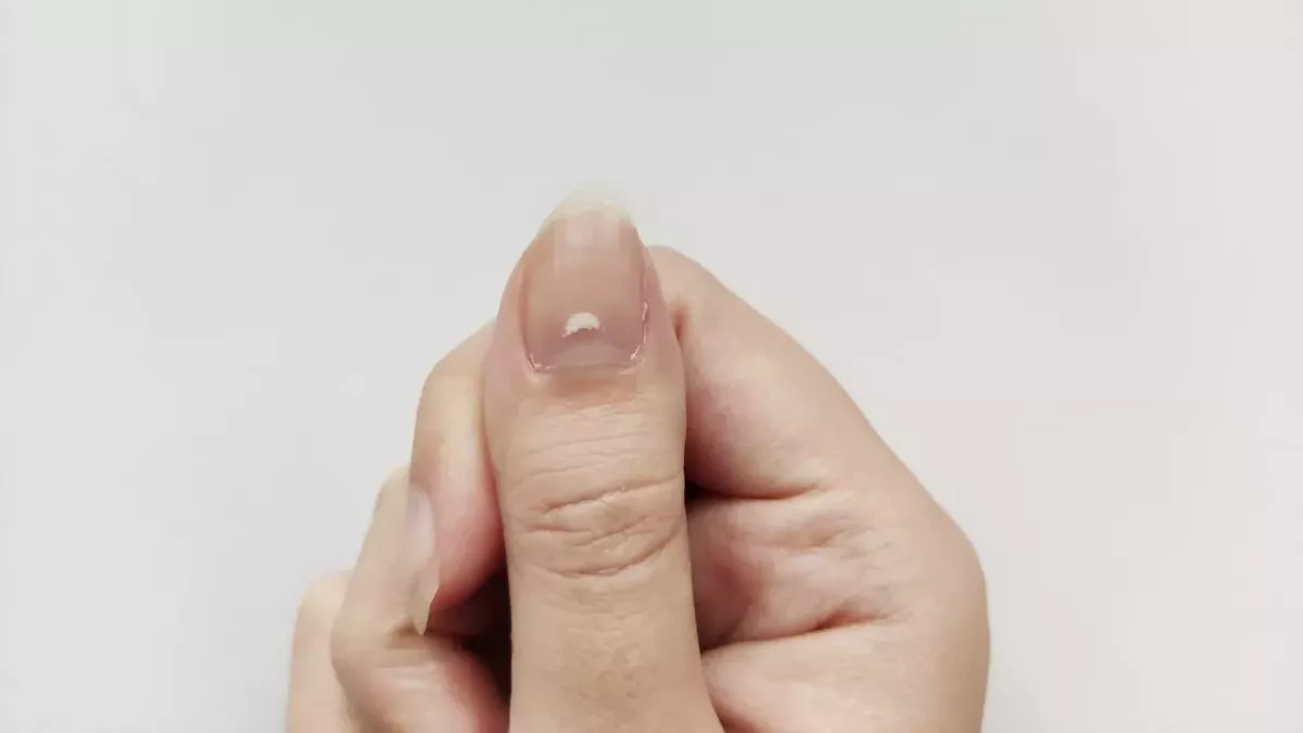 Nail with white mark