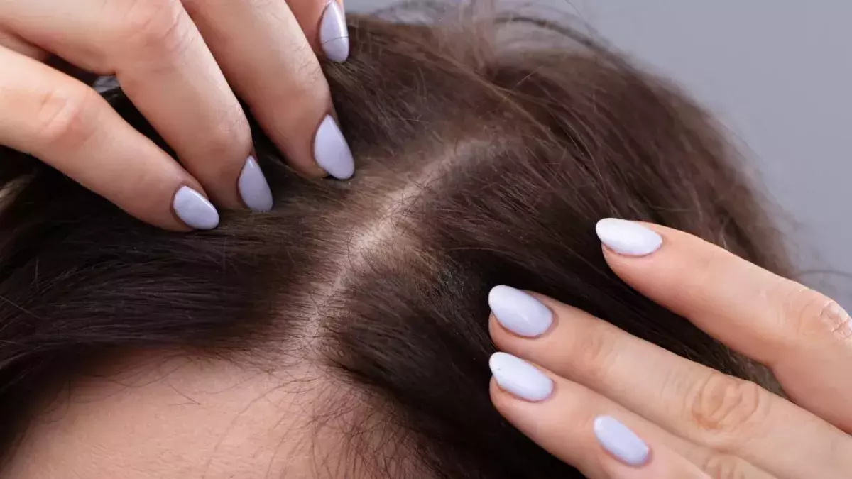 Nit Shampoo Found To Be An Effective Treatment Against COVID-19