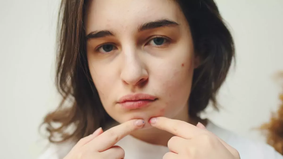 popping pimple danger triangle on face brain infection