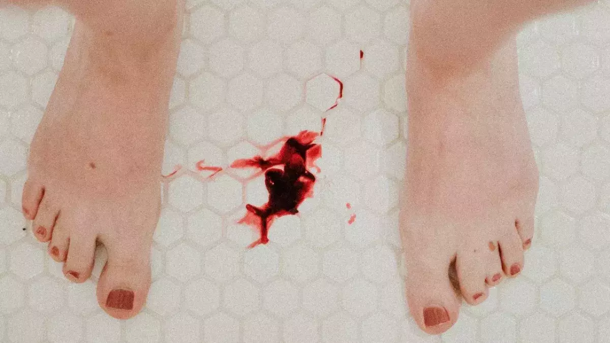 Post-jab bleeding