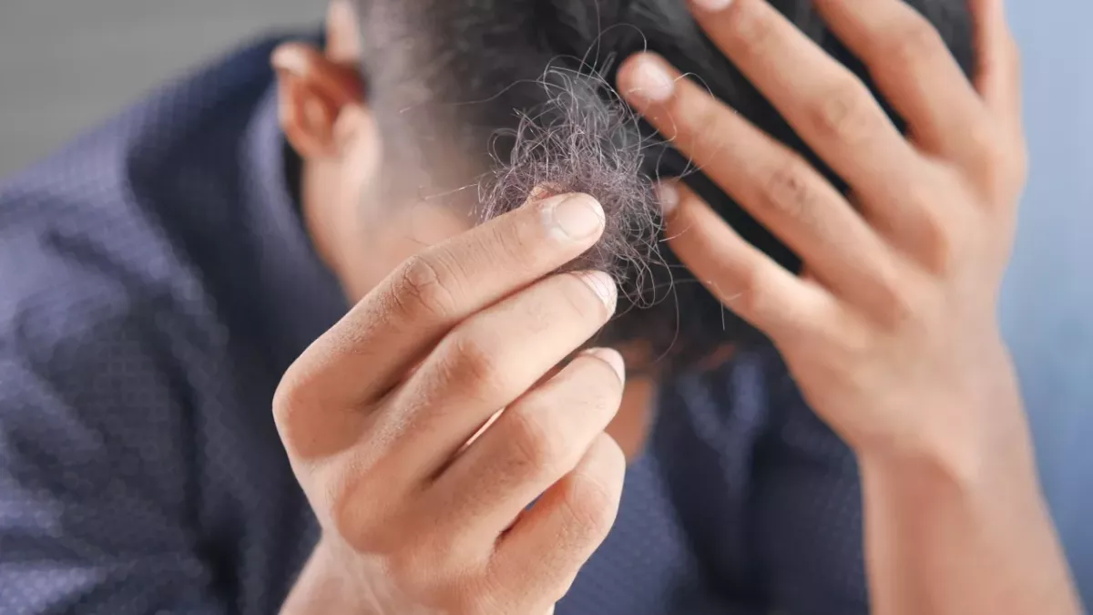 The real reason why men lose their hair more than women