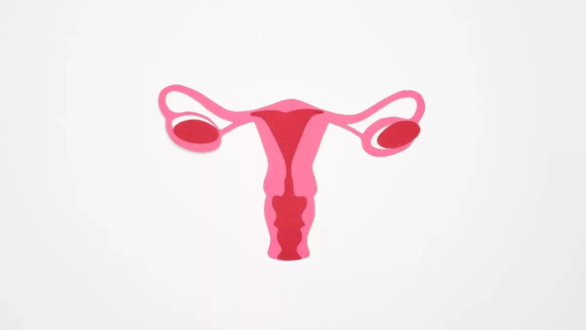 Retroverted uterus