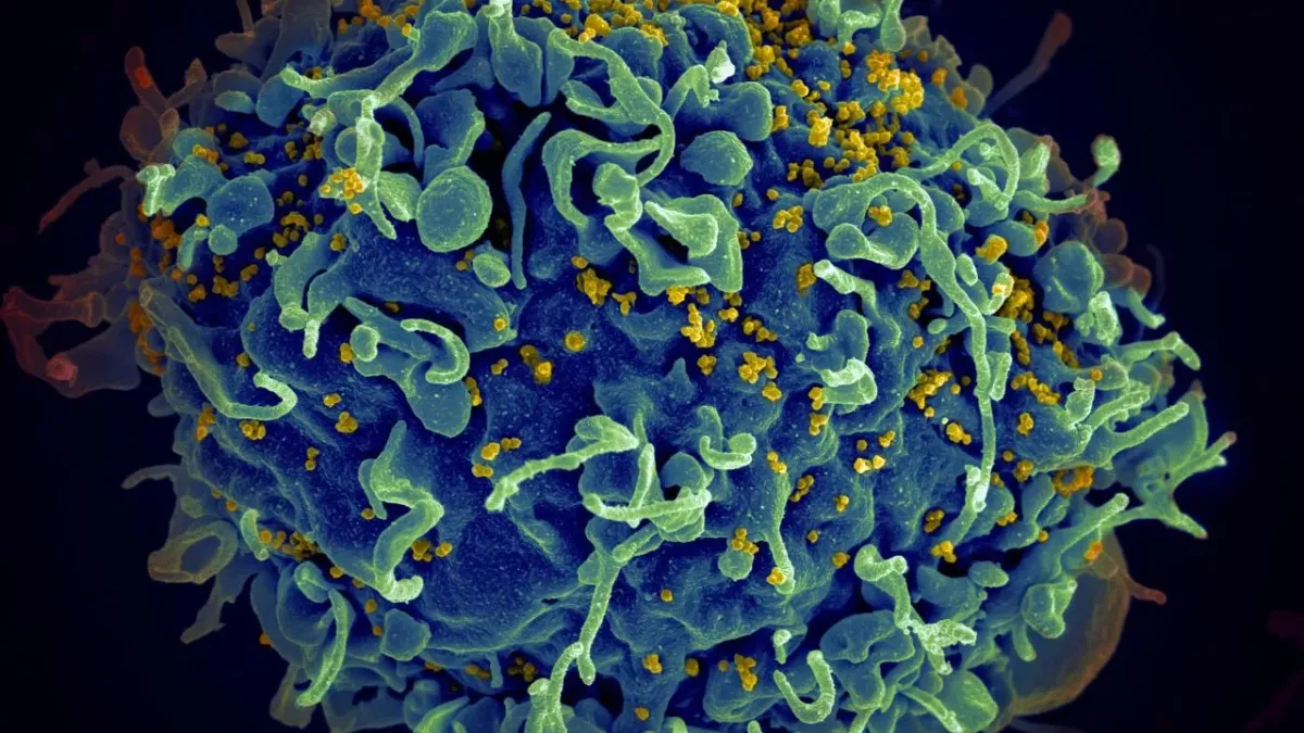 Third patient cured from HIV