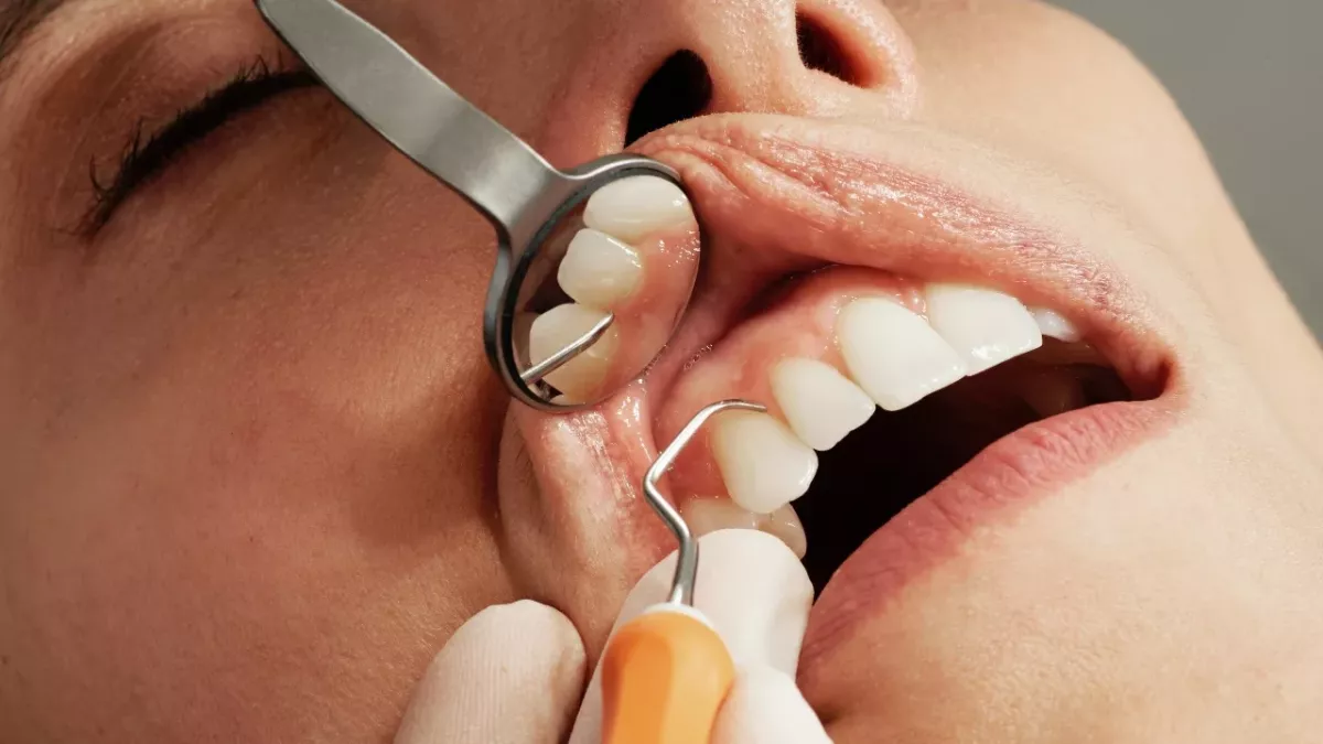 Tiktok dentist claims cavities are contagious - is it true?