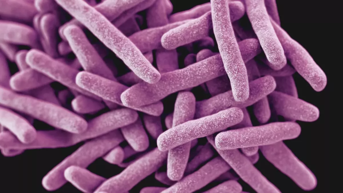 Tuberculosis and COVID: What are the different symptoms?