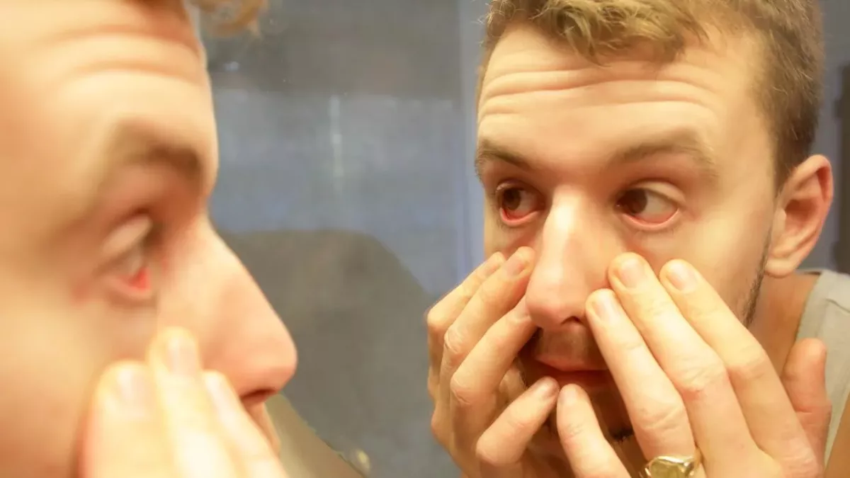 Watery eyes: Here's what it could mean for your health