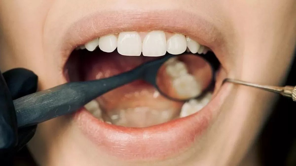 This is what the colour of your teeth says about your oral health