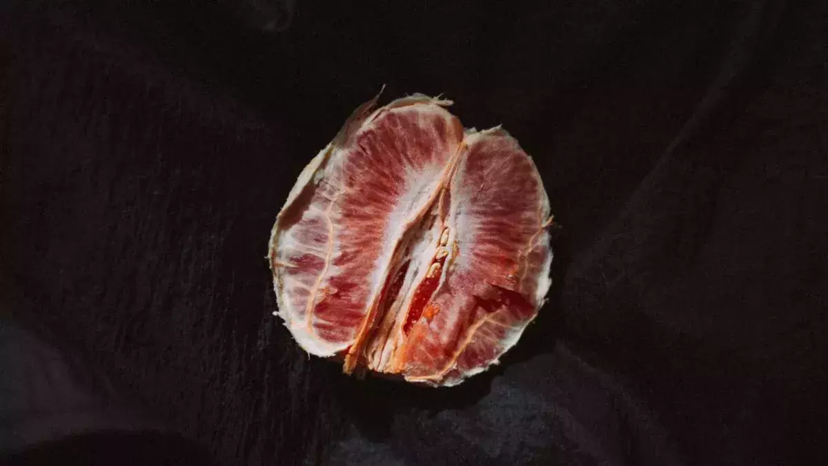 What is vaginal dryness?