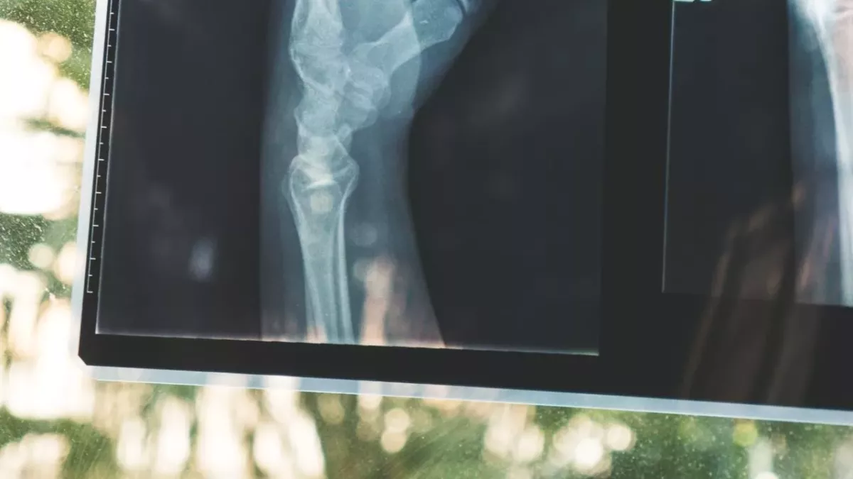 X-Ray