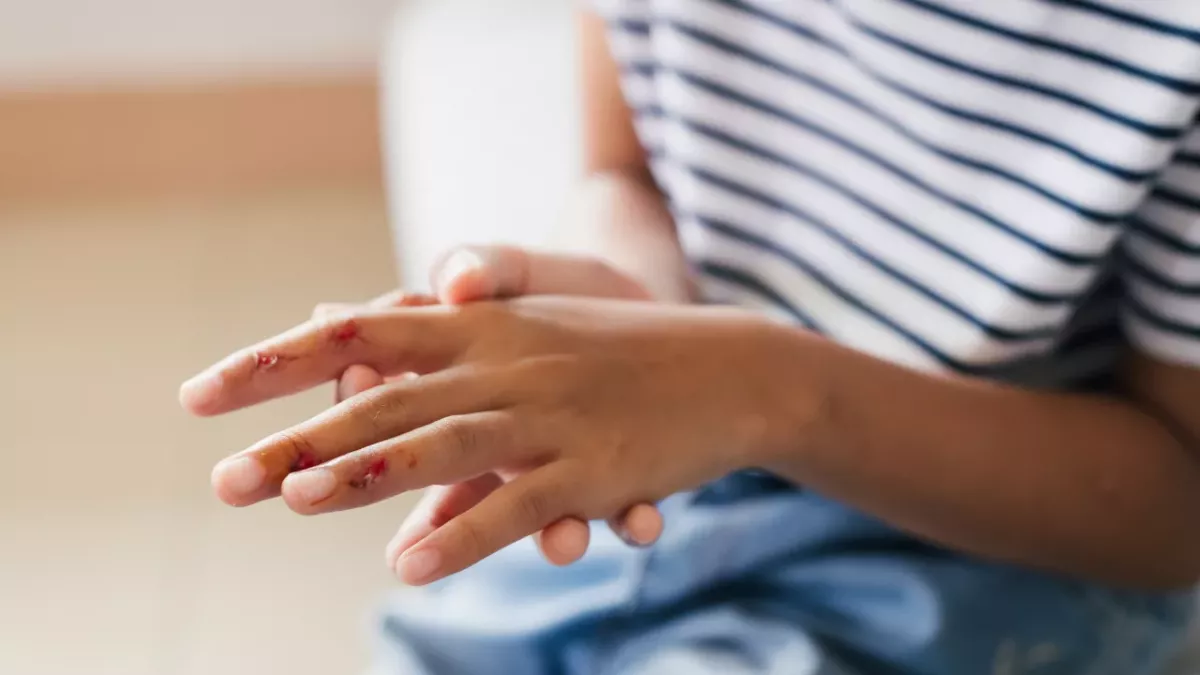 Is your wound Infected or healing? Here’s how to tell the difference