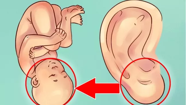 Ear shape