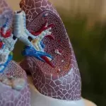 Chelsie Whibley: What is cystic fibrosis, the disease she died fighting?
