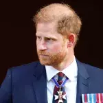 Prince Harry hair loss