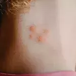 Shocking death of 19-year-old student following spider bite  