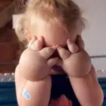 A 2-year-old girl with fat hands got liposuction!