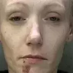 This 36-Year-Old Was Severely Addicted to Heroin