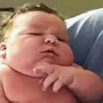 Baby When It Was Born Shocked Everyone