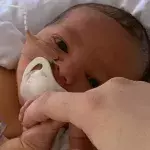 Baby’s stomach balloons up hours after being born, leaving mum scared
