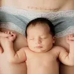 C-Section