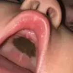 A Dark Spot in Her Baby's Mouth Made for an Embarrassing Doctor's Visit