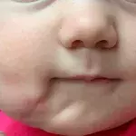 Default image