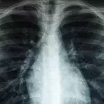 Doctors shocked to find this fragile object inserted in man's anus