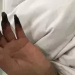 Her Hands Turned Black After Cleaning Her House.