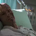 Man with severe burns receives a fish skin graft and the result is rather strange (PHOTO)