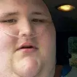 This Obese Young Man's Life Was Hanging By A Thread, 