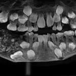 Teeth