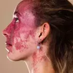 They Made Fun of Her Birthmark, but She's Turned It Into Something Inspiring