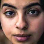 8 Amazing Home Remedies to get rid of Dark Spots