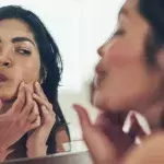 Acne vs Pimples, What’s The Difference?