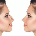 Default image