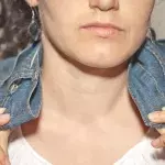 Default image