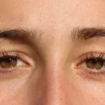 How alcohol affects the skin