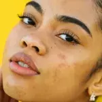 Skinceptance: Superdrug announces new free skin consultation service