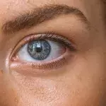 Tips and Tricks: get rid of undereye bags with these 5 tricks 