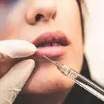Woman’s infected filler explodes, covering doctor in pus