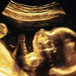 Baby scan
