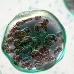 Biblical disease making a terrifying comeback in UK as cases soar