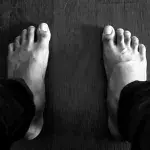 COVID toes