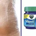 Default image