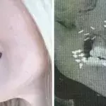 Default image