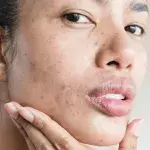 Skin positivity