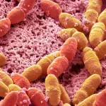 Strep A: The real reason for the outbreak has been revealed