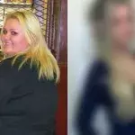 Weight loss