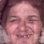 This Woman's Face Changed Drastically After She Underwent A Peculiar And Painful Procedure