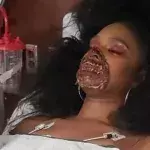 A Dancer In Zombie Makeup Ends Up In Hospital