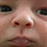 Default image
